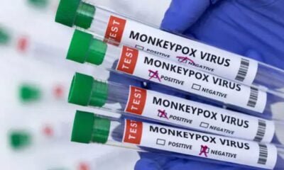 CDC Raises Monkeypox Alert As Global Cases Surpass 1,000