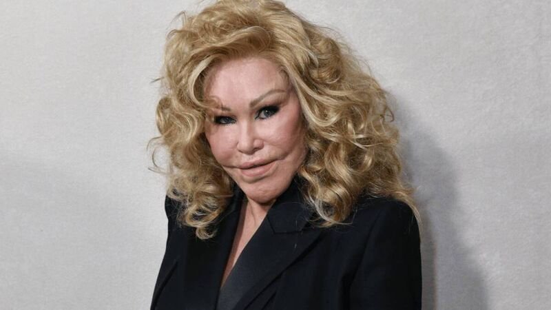 Jocelyne Wildenstein, 'Catwoman' Socialite Known for Extreme Cosmetic Surgery, Dies at 84