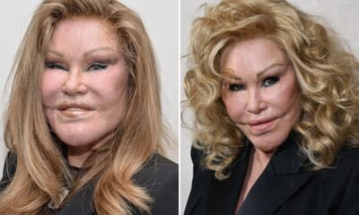 Jocelyne Wildenstein, 'Catwoman' Socialite Known for Extreme Cosmetic Surgery, Dies at 84