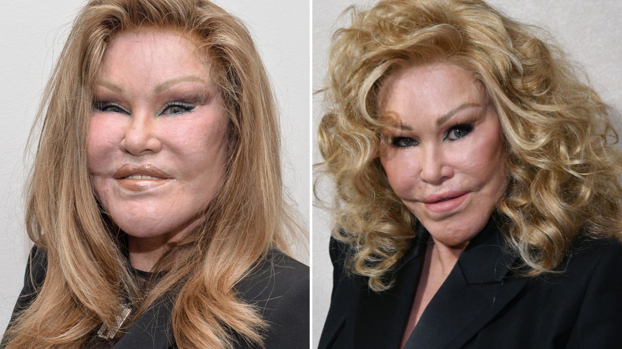 Jocelyne Wildenstein, 'Catwoman' Socialite Known for Extreme Cosmetic Surgery, Dies at 84